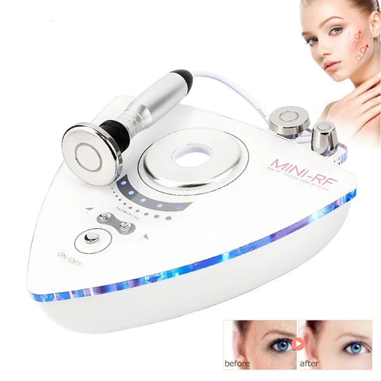 RF Multi-functional Skin Tightening Device: Home Use Radio Frequency Facial & Eye Lifter for Enhanced Skin Care