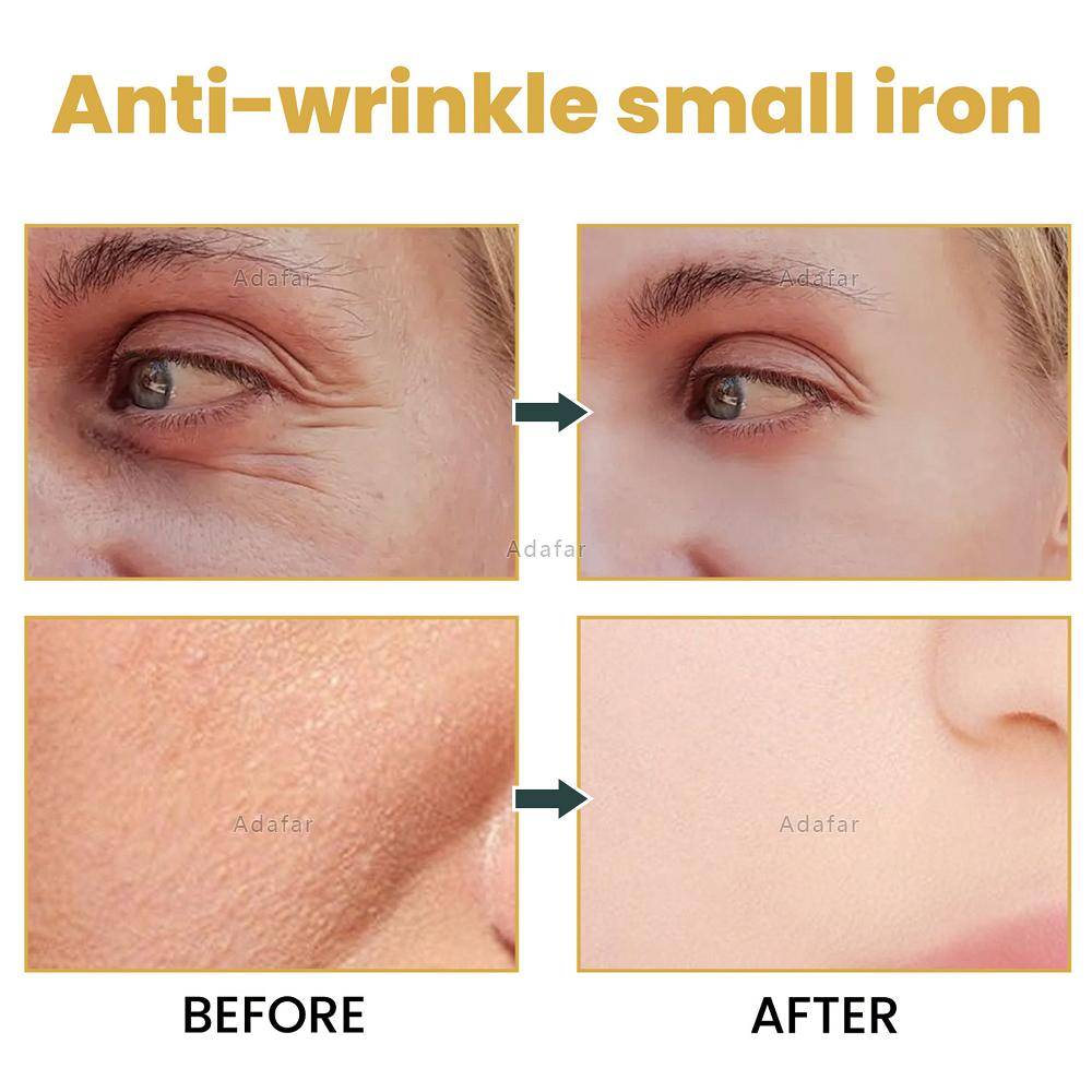 Ultrasonic Anti Aging Wrinkle Remover Facial Lift Machine Photon Therapy Treatment .