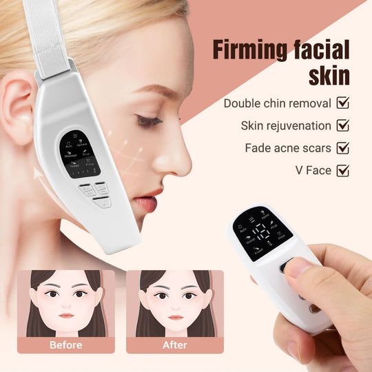 LED Photon Therapy & Heated Vibration Massager: Facial Slimming & Lifting Device for Double Chin Reduction and V-Face Contouring