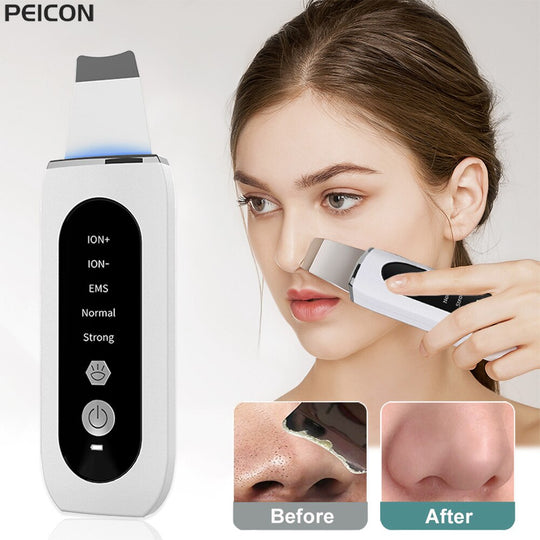 Ultrasonic Skin Scrubber Peeling Blackhead Remover Deep Face Cleaning Ultrasonic Ion Ance Pore Cleaner Facial Beauty Massage